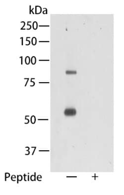 Invitrogen TMEM2 Polyclonal Antibody 100 μL; Unconjugated:Antibodies,