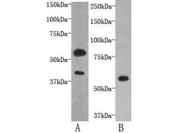 Invitrogen TMEM57 Polyclonal Antibody 100 μL; Unconjugated:Antibodies,