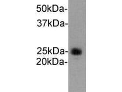 Invitrogen Ly-6G Polyclonal Antibody 100 &mu;L; Unconjugated:Antibodies,