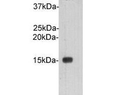 Invitrogen Cystatin C Polyclonal Antibody 100 &mu;L; Unconjugated:Antibodies,