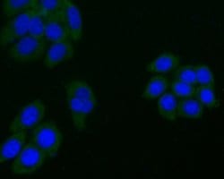 Invitrogen ARF1 Polyclonal Antibody 100 &mu;L; Unconjugated:Antibodies,