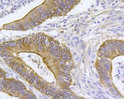 Invitrogen ARF1 Polyclonal Antibody 100 &mu;L; Unconjugated:Antibodies,