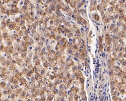 Invitrogen ARF1 Polyclonal Antibody 100 &mu;L; Unconjugated:Antibodies,