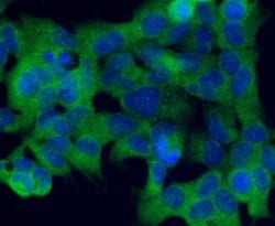 Invitrogen CD235a (Glycophorin A) Polyclonal Antibody 100 &mu;L; Unconjugated:Antibodies,