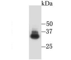 Invitrogen CD235a (Glycophorin A) Polyclonal Antibody 100 &mu;L; Unconjugated:Antibodies,