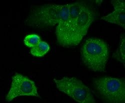 Invitrogen CD3 zeta (CD247) Polyclonal Antibody 100 &mu;L; Unconjugated:Antibodies,