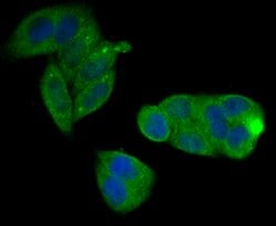 Invitrogen CD3 zeta (CD247) Polyclonal Antibody 100 &mu;L; Unconjugated:Antibodies,