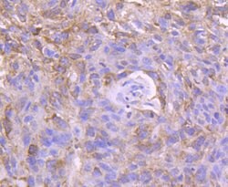 Invitrogen CD171 (L1CAM) Polyclonal Antibody 100 &mu;L; Unconjugated:Antibodies,