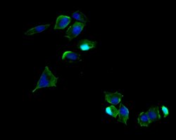 Invitrogen CD171 (L1CAM) Polyclonal Antibody 100 &mu;L; Unconjugated:Antibodies,