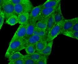 Invitrogen CD171 (L1CAM) Polyclonal Antibody 100 &mu;L; Unconjugated:Antibodies,