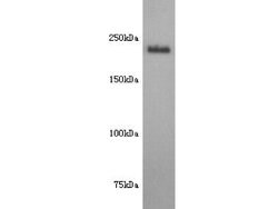 Invitrogen CD171 (L1CAM) Polyclonal Antibody 100 &mu;L; Unconjugated:Antibodies,