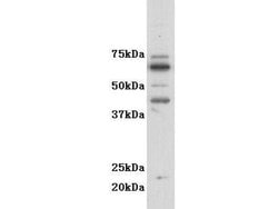 Invitrogen CSF2RA Polyclonal Antibody 100 &mu;L; Unconjugated:Antibodies,
