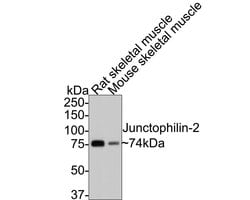 Invitrogen JPH2 Polyclonal Antibody 100 &mu;L | Buy Online | Invitrogen&trade; | Fisher Scientific