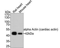 Invitrogen alpha-Cardiac Actin Polyclonal Antibody 100 &mu;L; Unconjugated:Antibodies,