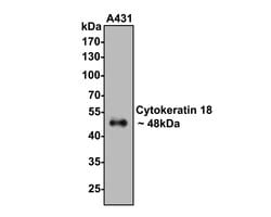 Invitrogen Cytokeratin 18 Polyclonal Antibody 100 &mu;L; Unconjugated:Antibodies,