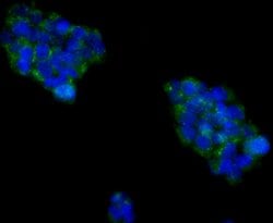Invitrogen Cytokeratin 18 Polyclonal Antibody 100 &mu;L; Unconjugated:Antibodies,