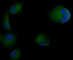 Invitrogen Cytokeratin 18 Polyclonal Antibody 100 &mu;L; Unconjugated:Antibodies,