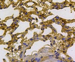 Invitrogen Cytokeratin 18 Polyclonal Antibody 100 &mu;L; Unconjugated:Antibodies,