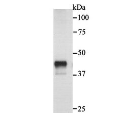 Invitrogen Cytokeratin 18 Polyclonal Antibody 100 &mu;L; Unconjugated:Antibodies,