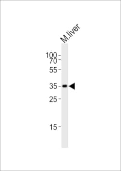 Invitrogen HMX2 Polyclonal Antibody 400 &mu;L | Buy Online | Invitrogen&trade; | Fisher Scientific