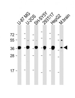 Invitrogen EN1 Polyclonal Antibody 200 &mu;L; Unconjugated:Antibodies,