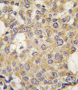 Invitrogen PARG Polyclonal Antibody 400 &mu;L; Unconjugated:Antibodies,