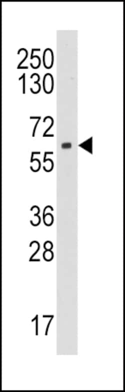 Invitrogen Aromatase Polyclonal Antibody 400 &mu;L; Unconjugated:Antibodies,