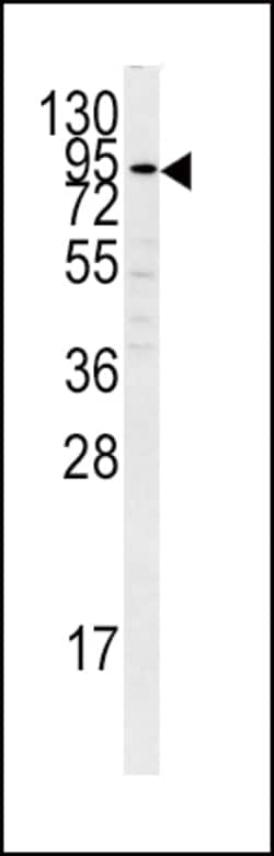 Invitrogen Plasminogen Polyclonal Antibody 400 &mu;L; Unconjugated:Antibodies,