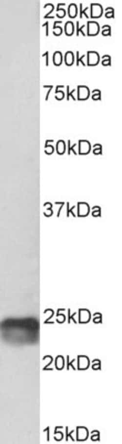 Invitrogen SOCS1 Polyclonal Antibody, Biotin 100 μg; Biotin:Antibodies,
