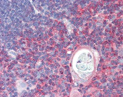 Invitrogen TXK Polyclonal Antibody 100 &mu;g | Buy Online | Invitrogen&trade; | Fisher Scientific