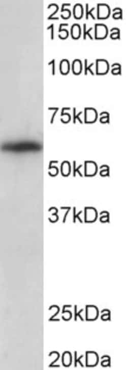 Invitrogen TXK Polyclonal Antibody 100 &mu;g | Buy Online | Invitrogen&trade; | Fisher Scientific