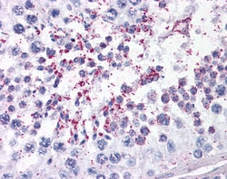 Invitrogen DUSP14 Polyclonal Antibody 100 &mu;g; Unconjugated:Antibodies,