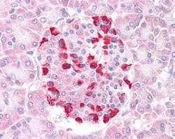 Invitrogen SOCS4 Polyclonal Antibody 100 &mu;g; Unconjugated:Antibodies,