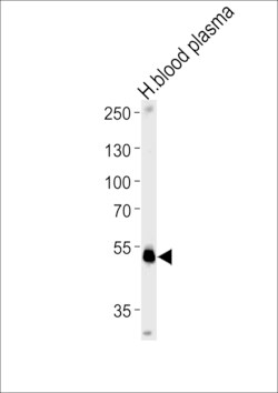 Invitrogen PEDF Polyclonal Antibody 400 &mu;L; Unconjugated:Antibodies,