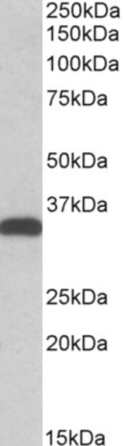 Invitrogen CBR3 Polyclonal Antibody 100 &mu;g; Unconjugated:Antibodies,