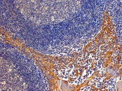 Invitrogen Importin 8 Polyclonal Antibody 100 &mu;g; Unconjugated:Antibodies,