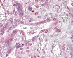 Invitrogen NFATC4 Polyclonal Antibody 100 &mu;g; Unconjugated:Antibodies,