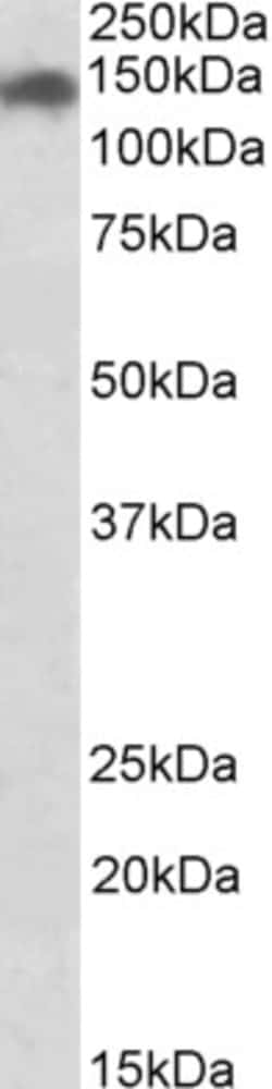 Invitrogen SMC2 Polyclonal Antibody 100 &mu;g | Buy Online | Invitrogen&trade; | Fisher Scientific
