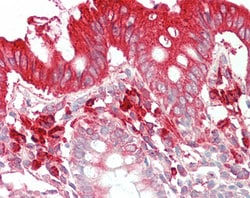 Invitrogen TFB2M Polyclonal Antibody 100 &mu;g; Unconjugated:Antibodies,