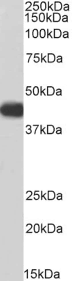 Invitrogen ACADM Polyclonal Antibody, Biotin 100 &mu;g; Biotin:Antibodies,