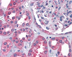 Invitrogen AS3MT Polyclonal Antibody 100 &mu;g; Unconjugated:Antibodies,