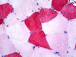Invitrogen UBE2O Polyclonal Antibody 100 &mu;g; Unconjugated:Antibodies,