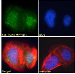 Invitrogen ZMYND11 Polyclonal Antibody 100 &mu;g; Unconjugated:Antibodies,