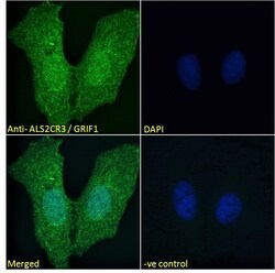 Invitrogen TRAK2 Polyclonal Antibody 100 &mu;g; Unconjugated:Antibodies,