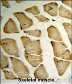 Invitrogen MFAP5 Polyclonal Antibody 400 &mu;L | Buy Online | Invitrogen&trade; | Fisher Scientific