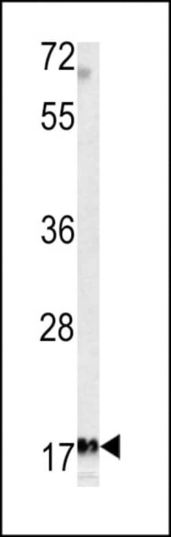 Invitrogen MFAP5 Polyclonal Antibody 400 &mu;L | Buy Online | Invitrogen&trade; | Fisher Scientific