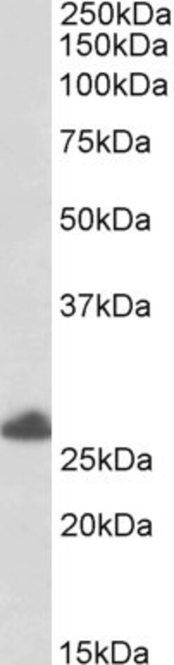 Invitrogen TRIM40 Polyclonal Antibody 100 &mu;g; Unconjugated:Antibodies,