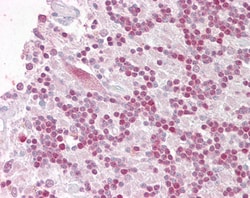 Invitrogen RNF36 Polyclonal Antibody 100 &mu;g; Unconjugated:Antibodies,