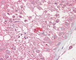 Invitrogen RNF36 Polyclonal Antibody 100 &mu;g; Unconjugated:Antibodies,