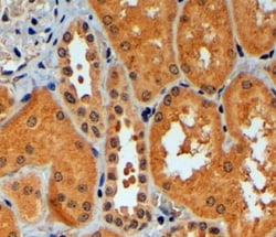 Invitrogen RNF92 Polyclonal Antibody 100 &mu;g; Unconjugated:Antibodies,
